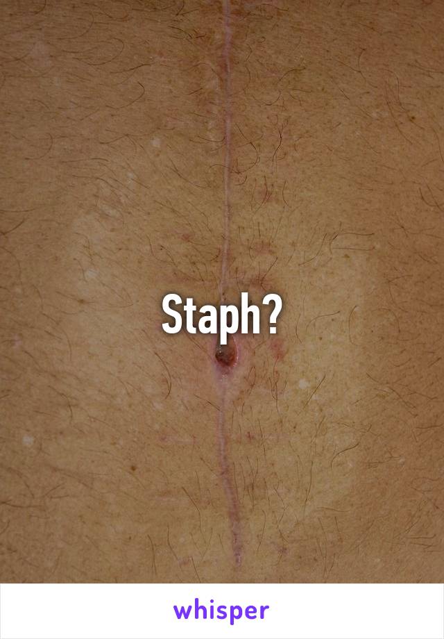 Staph?