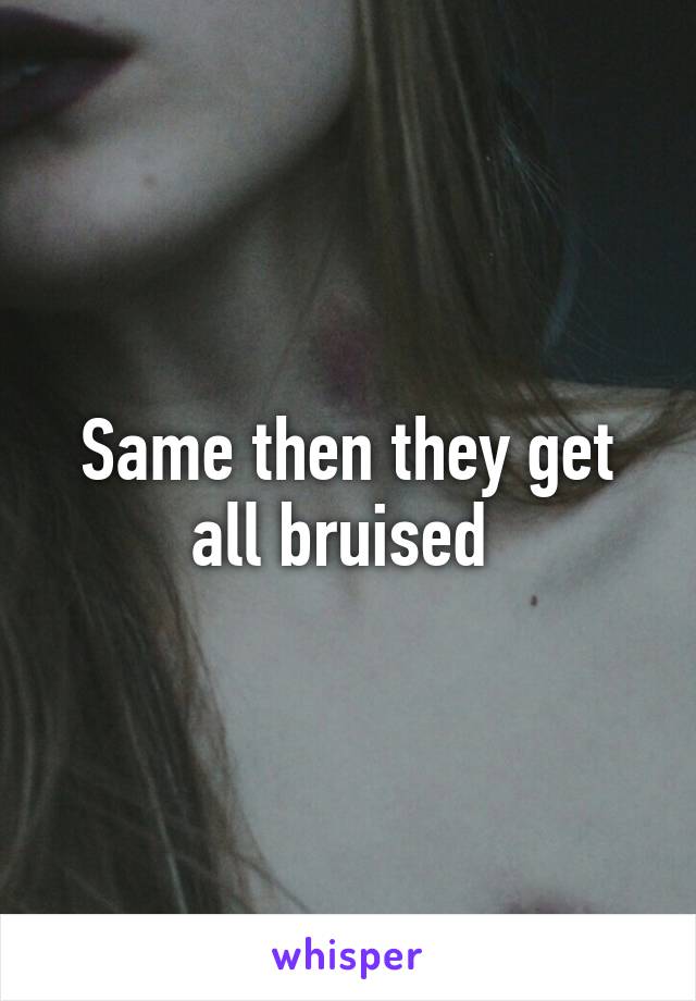 Same then they get all bruised 