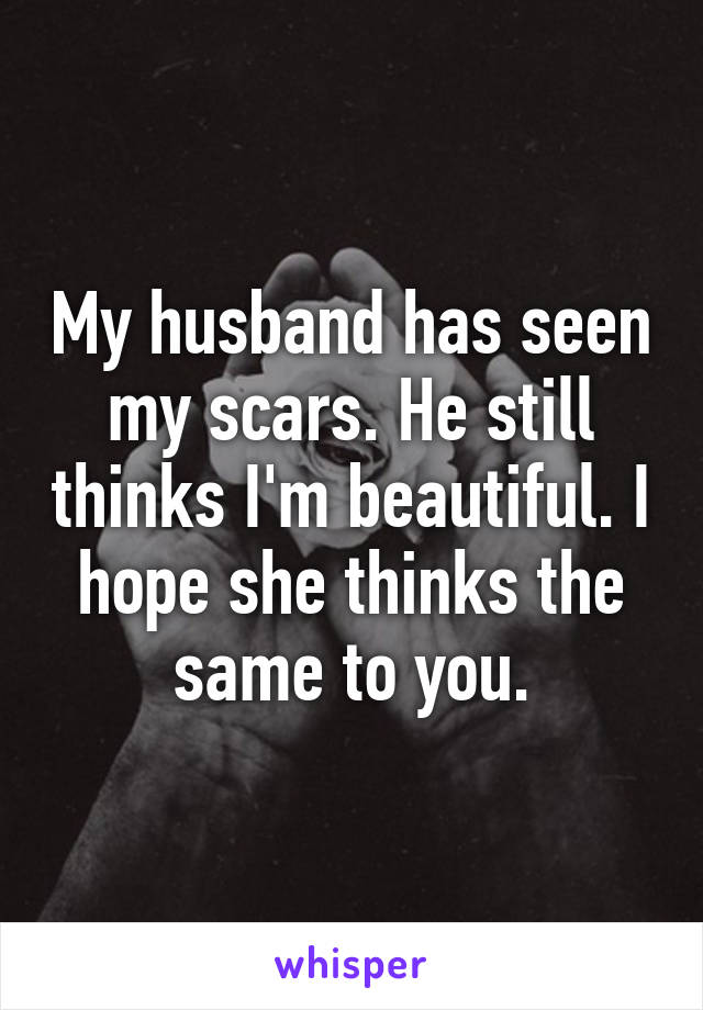 My husband has seen my scars. He still thinks I'm beautiful. I hope she thinks the same to you.