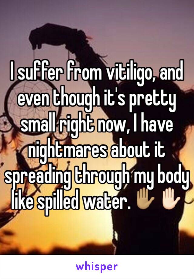 I suffer from vitiligo, and even though it's pretty small right now, I have nightmares about it spreading through my body like spilled water.✋🏽✋🏻