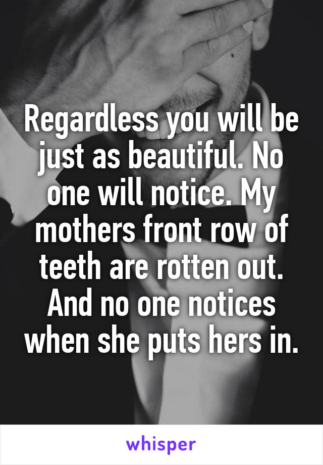 Regardless you will be just as beautiful. No one will notice. My mothers front row of teeth are rotten out. And no one notices when she puts hers in.