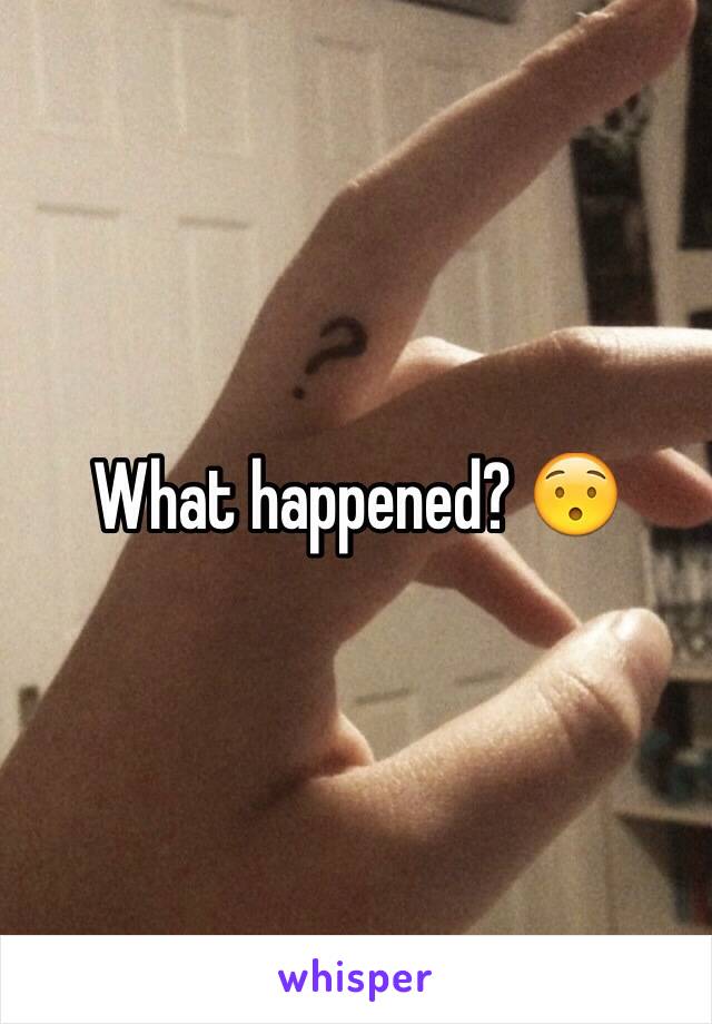 What happened? 😯