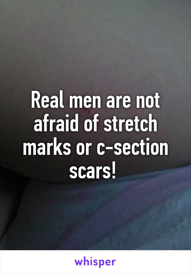 Real men are not afraid of stretch marks or c-section scars! 