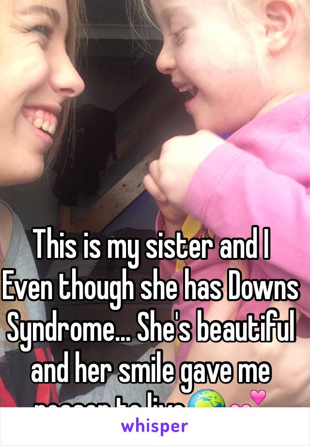 This is my sister and I
Even though she has Downs Syndrome... She's beautiful and her smile gave me reason to live🌍💕