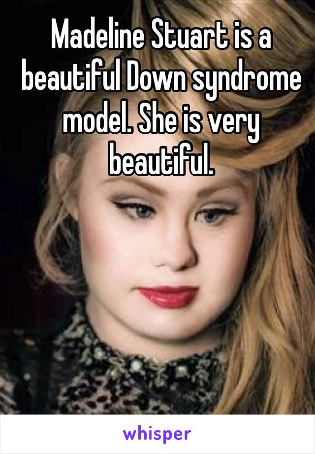 Madeline Stuart is a beautiful Down syndrome model. She is very beautiful.