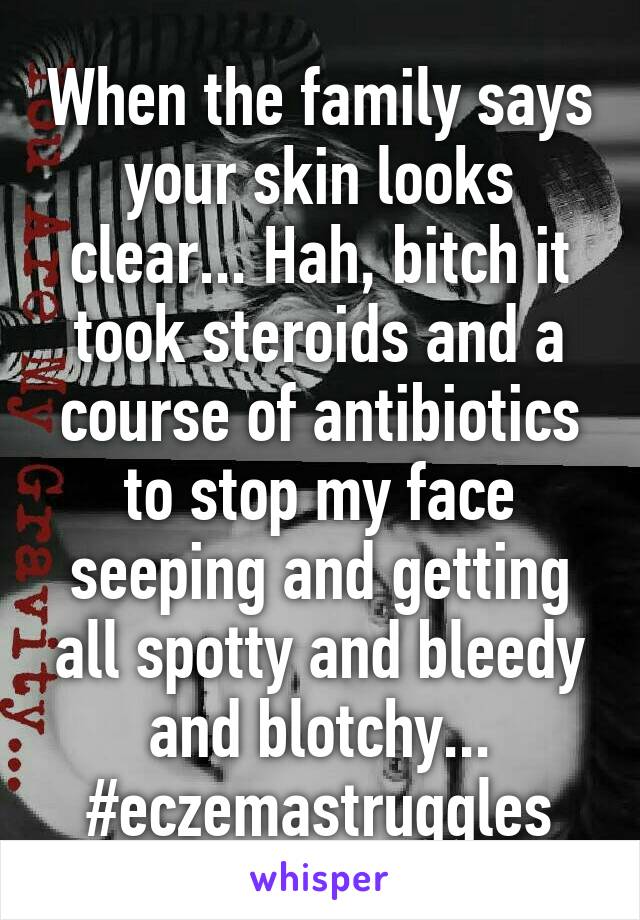 When the family says your skin looks clear... Hah, bitch it took steroids and a course of antibiotics to stop my face seeping and getting all spotty and bleedy and blotchy... #eczemastruggles