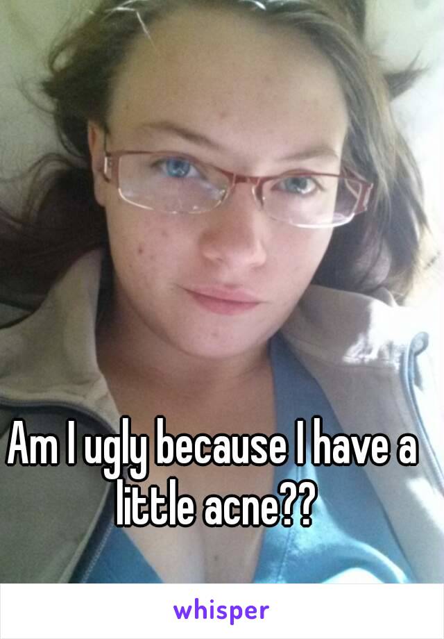 Am I ugly because I have a little acne??