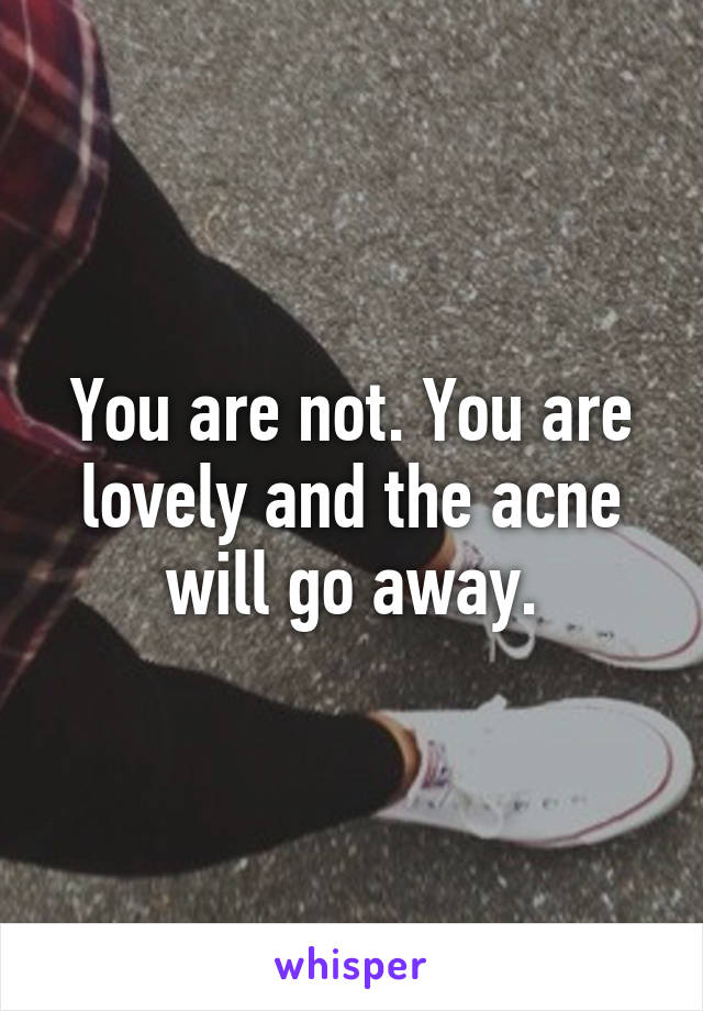 You are not. You are lovely and the acne will go away.
