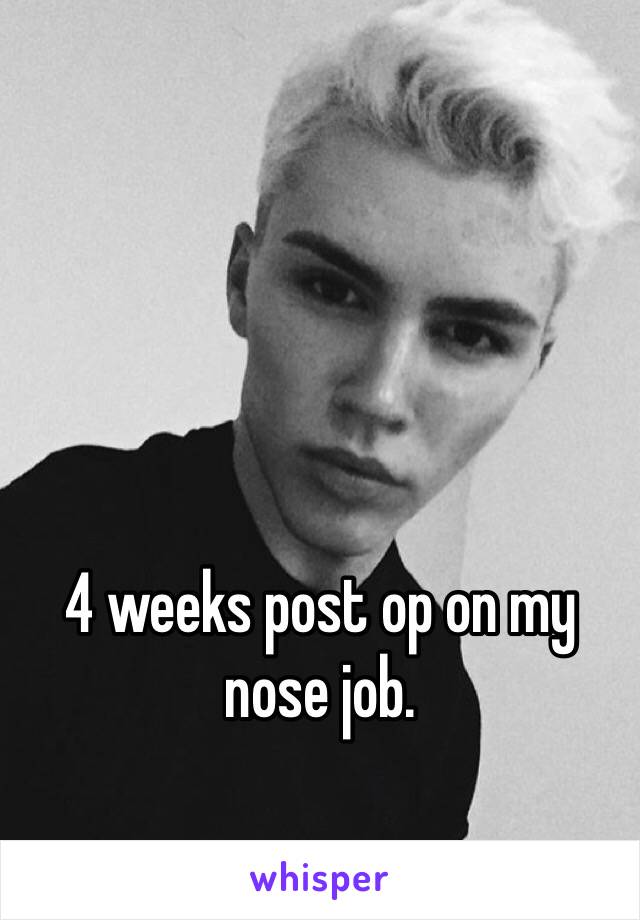 4 weeks post op on my nose job. 