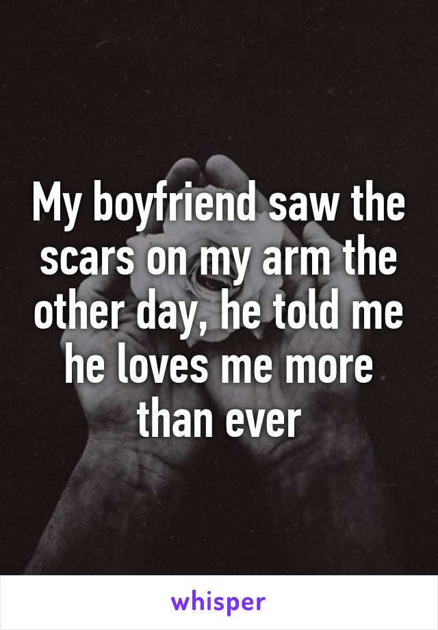 My boyfriend saw the scars on my arm the other day, he told me he loves me more than ever