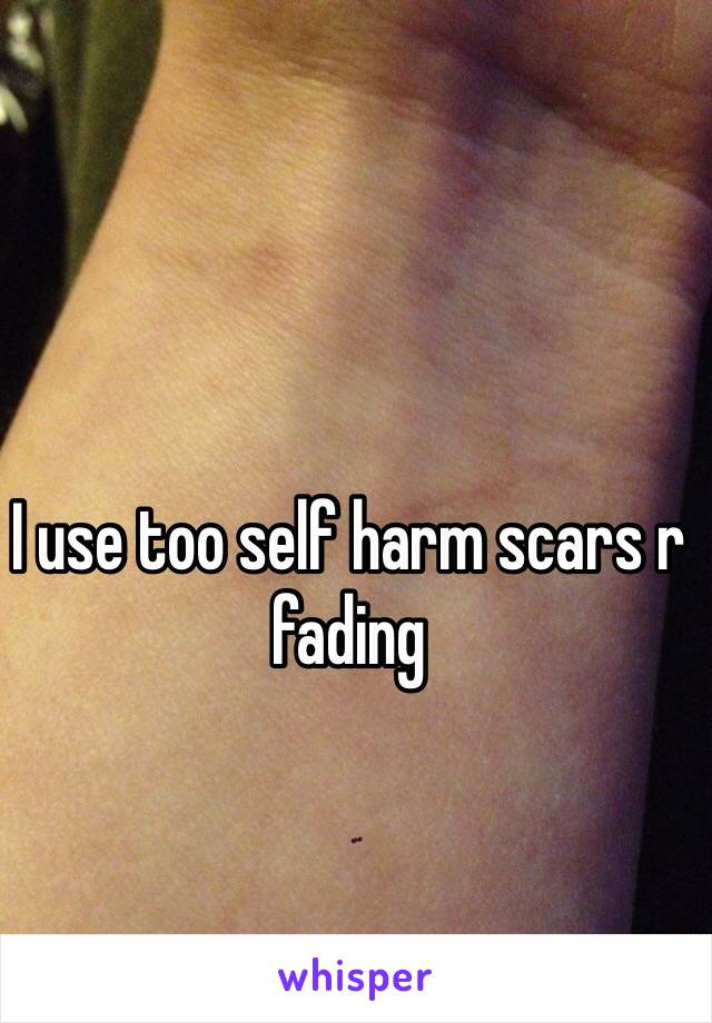 I use too self harm scars r fading 