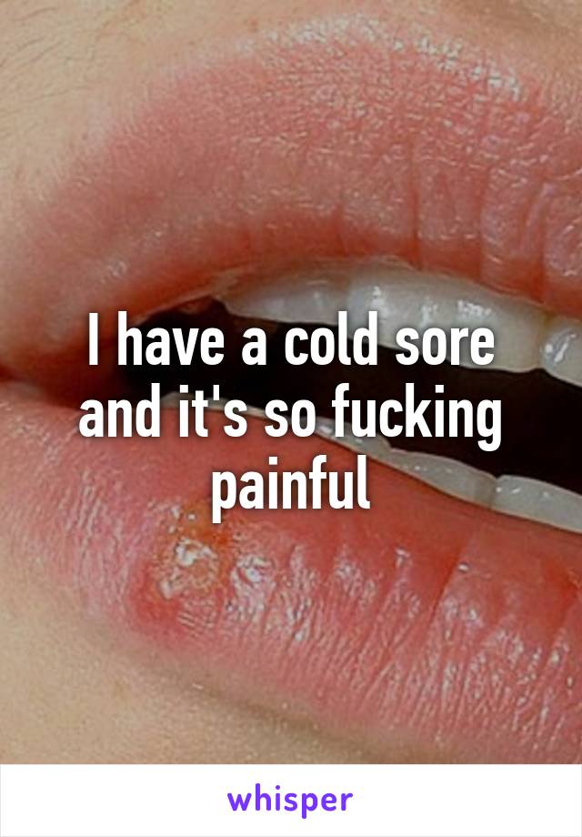 I have a cold sore and it's so fucking painful