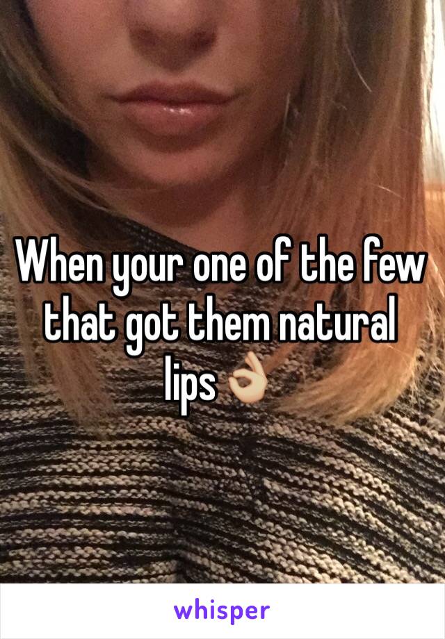 When your one of the few that got them natural lips👌🏼