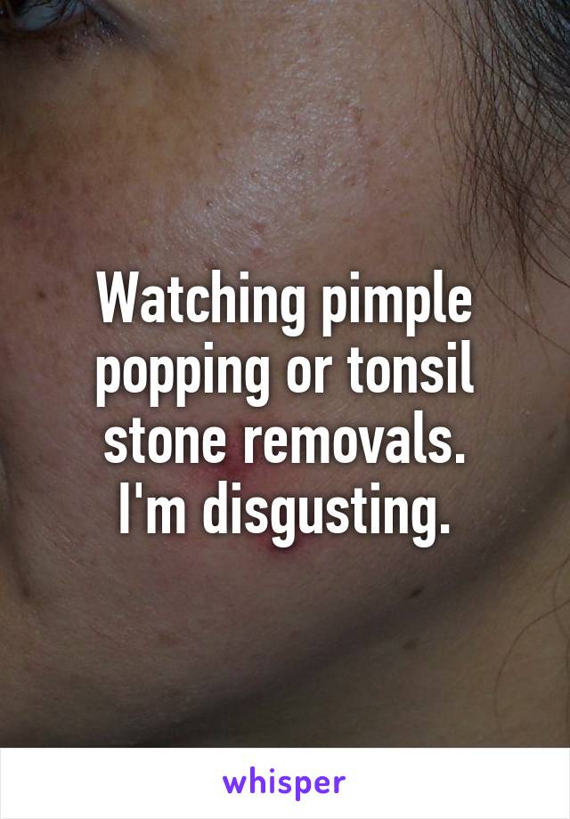 Watching pimple popping or tonsil stone removals.
I'm disgusting.