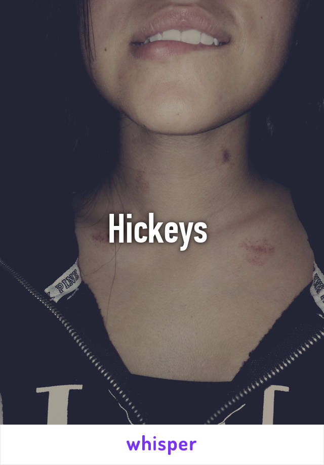 Hickeys 