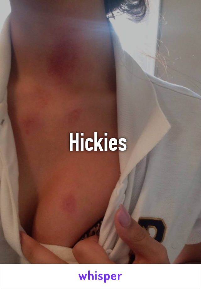 Hickies 