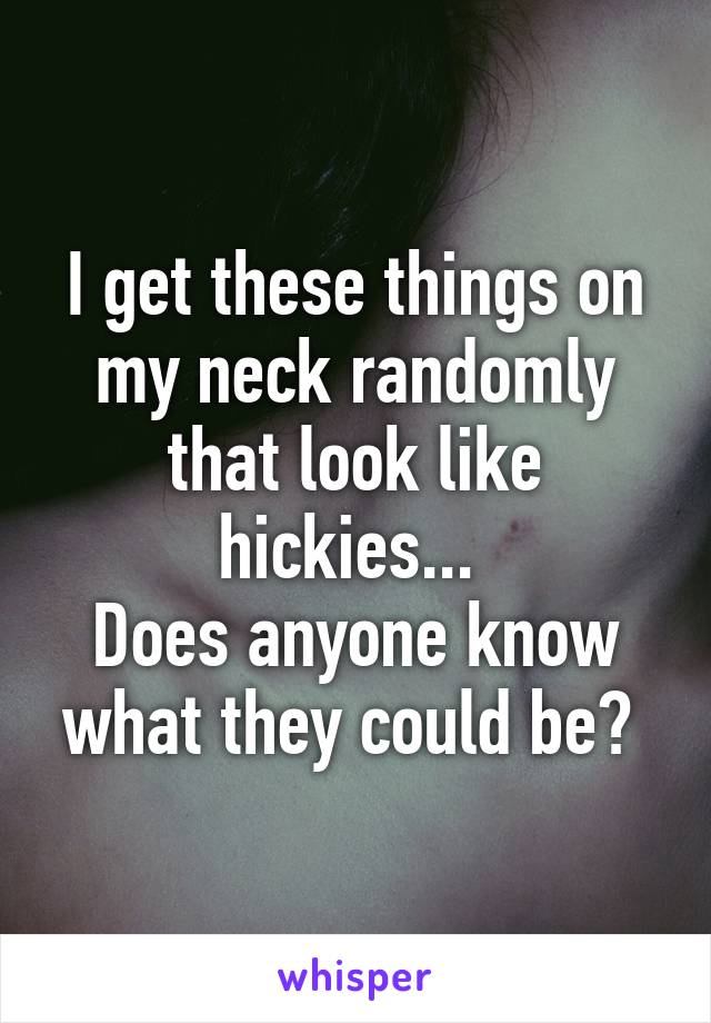I get these things on my neck randomly that look like hickies... 
Does anyone know what they could be? 
