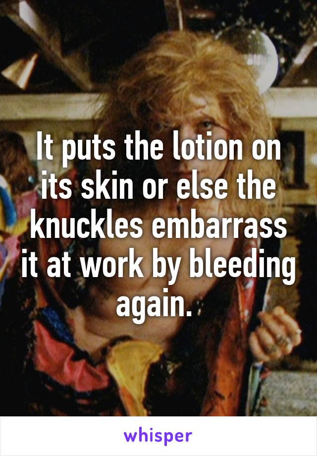 It puts the lotion on its skin or else the knuckles embarrass it at work by bleeding again. 