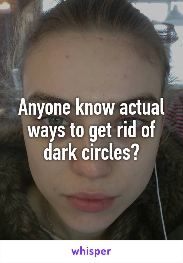 Anyone know actual ways to get rid of dark circles?