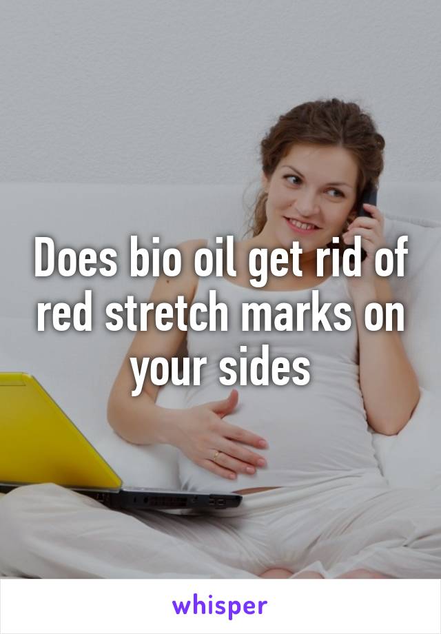 Does bio oil get rid of red stretch marks on your sides