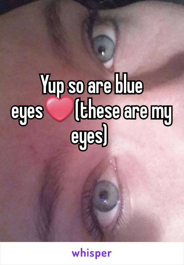 Yup so are blue eyes❤(these are my eyes) 