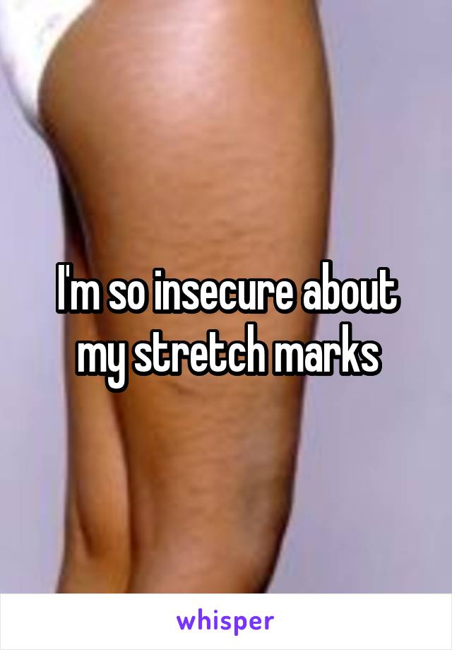 I'm so insecure about my stretch marks