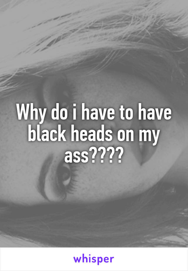 Why do i have to have black heads on my ass????