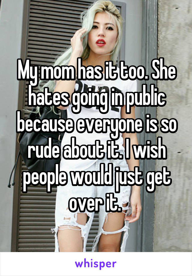 My mom has it too. She hates going in public because everyone is so rude about it. I wish people would just get over it. 
