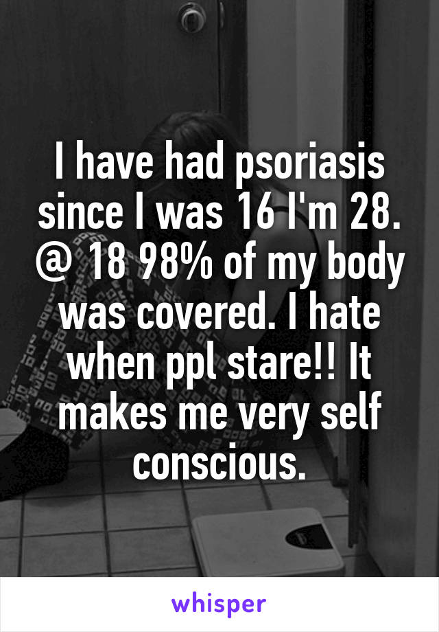 I have had psoriasis since I was 16 I'm 28. @ 18 98% of my body was covered. I hate when ppl stare!! It makes me very self conscious.