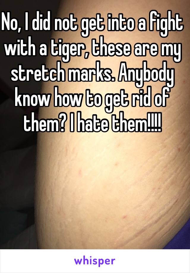 No, I did not get into a fight with a tiger, these are my stretch marks. Anybody know how to get rid of them? I hate them!!!!
