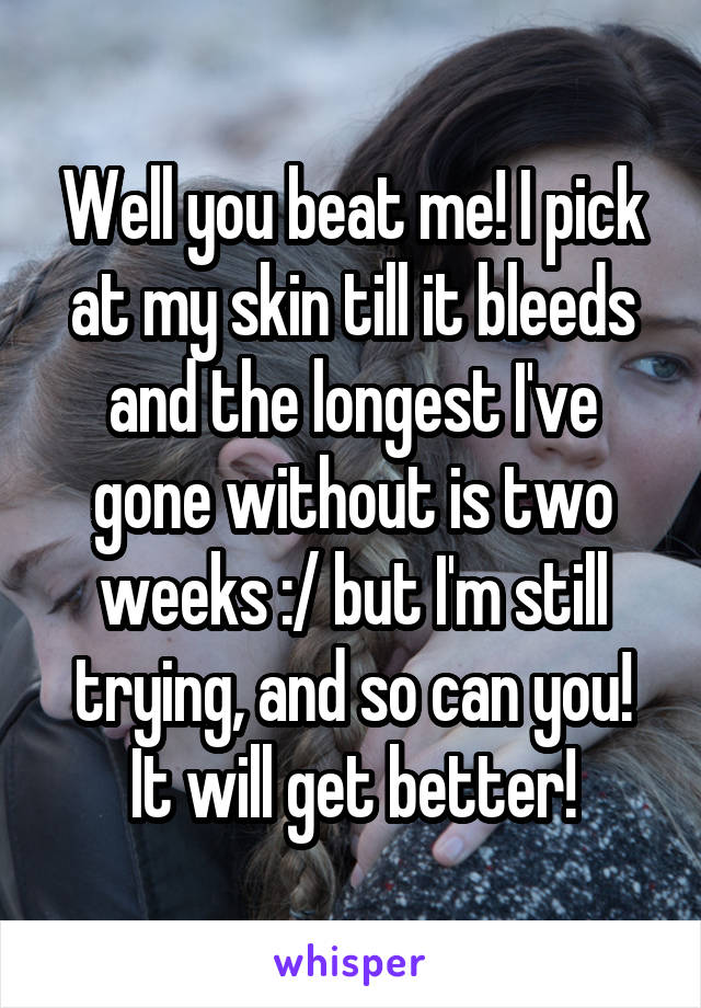 Well you beat me! I pick at my skin till it bleeds and the longest I've gone without is two weeks :/ but I'm still trying, and so can you! It will get better!