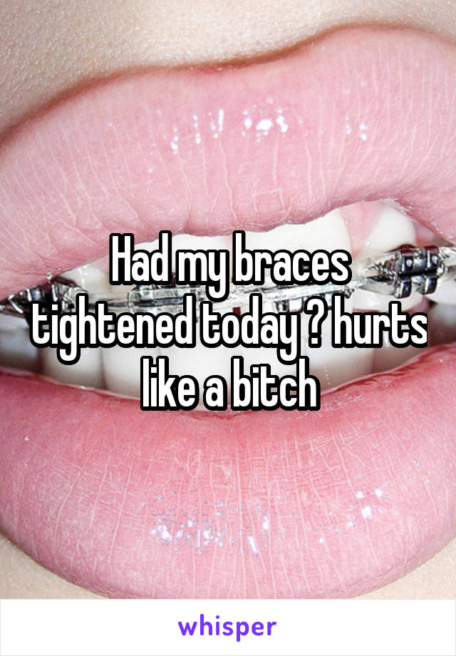 Had my braces tightened today 😐 hurts like a bitch