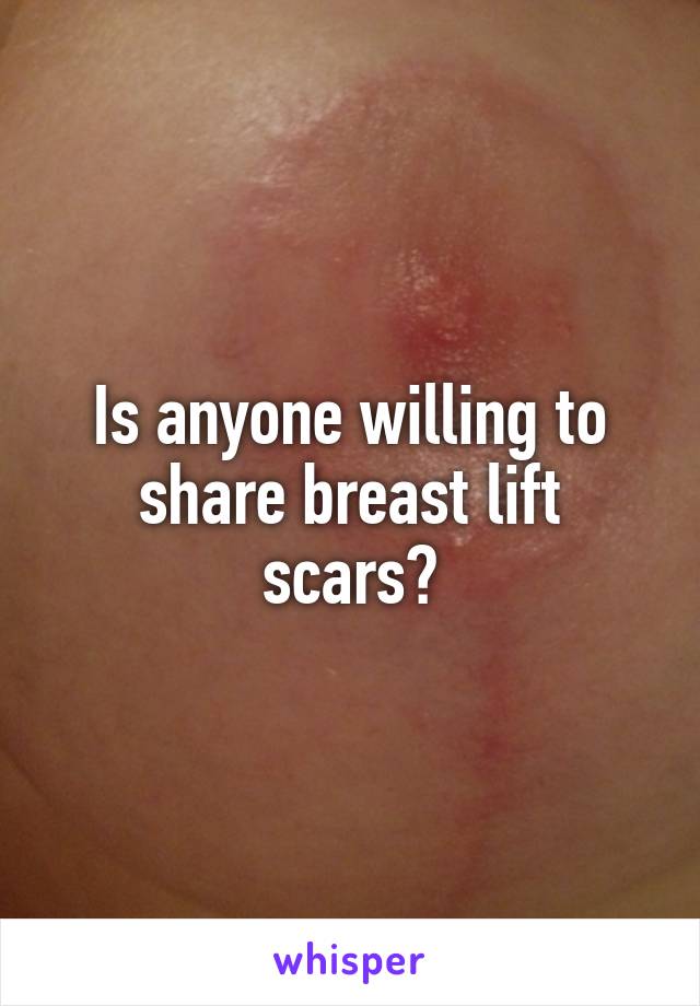 Is anyone willing to share breast lift scars?