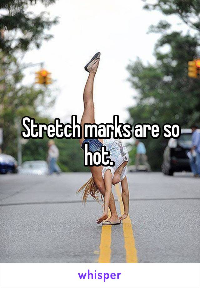 Stretch marks are so hot. 