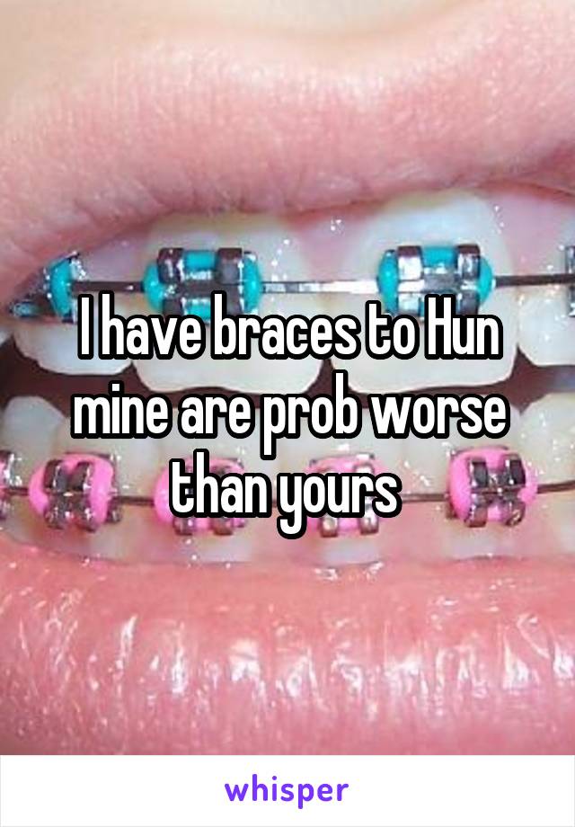 I have braces to Hun mine are prob worse than yours 