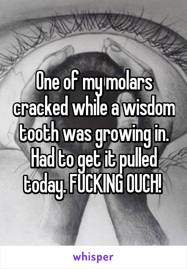 One of my molars cracked while a wisdom tooth was growing in. Had to get it pulled today. FUCKING OUCH! 