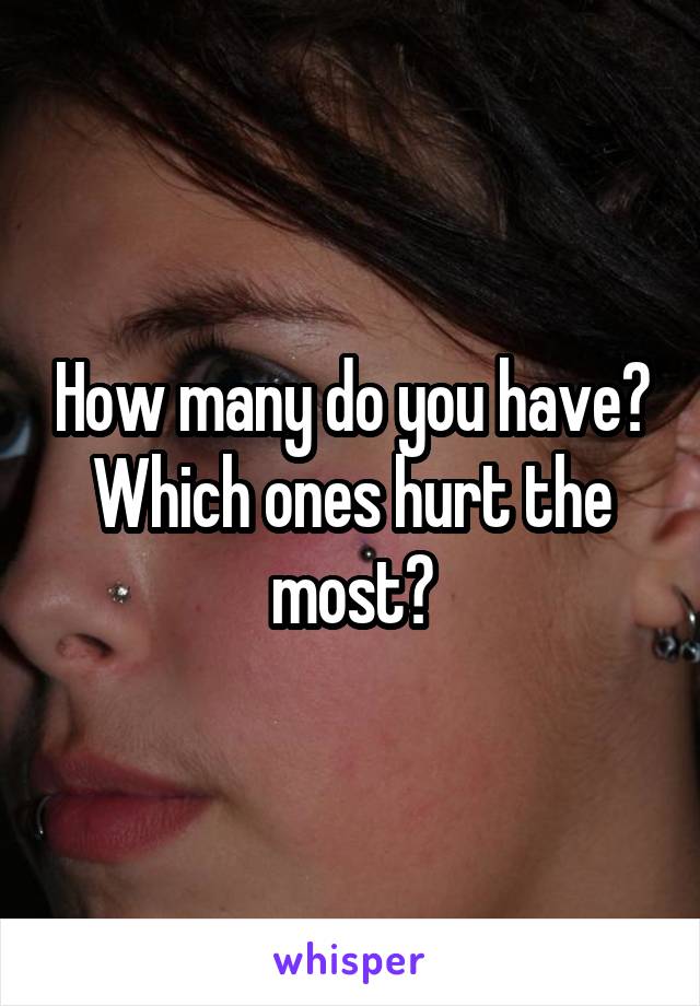 How many do you have? Which ones hurt the most?