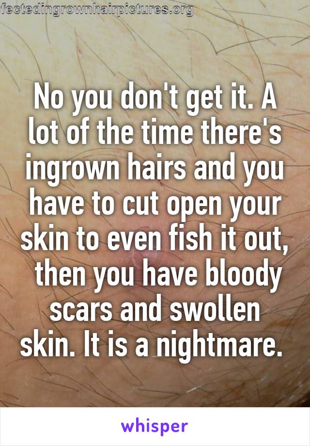 No you don't get it. A lot of the time there's ingrown hairs and you have to cut open your skin to even fish it out,  then you have bloody scars and swollen skin. It is a nightmare. 