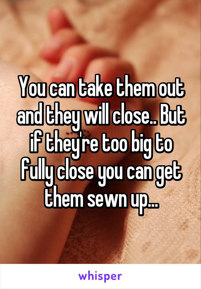 You can take them out and they will close.. But if they're too big to fully close you can get them sewn up...