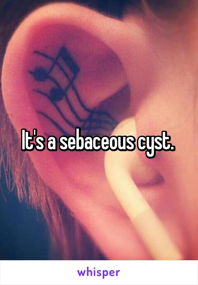It's a sebaceous cyst. 