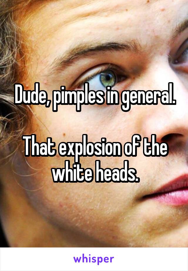 Dude, pimples in general.

That explosion of the white heads.