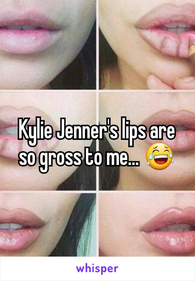 Kylie Jenner's lips are so gross to me... 😂