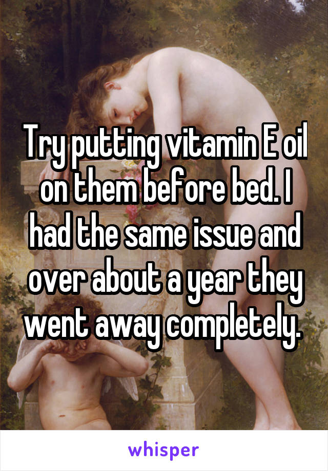 Try putting vitamin E oil on them before bed. I had the same issue and over about a year they went away completely. 
