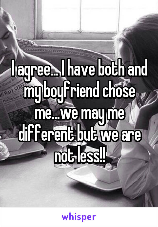 I agree... I have both and my boyfriend chose me...we may me different but we are not less!!