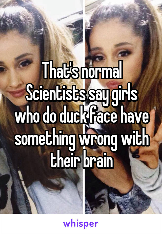 That's normal
Scientists say girls who do duck face have something wrong with their brain