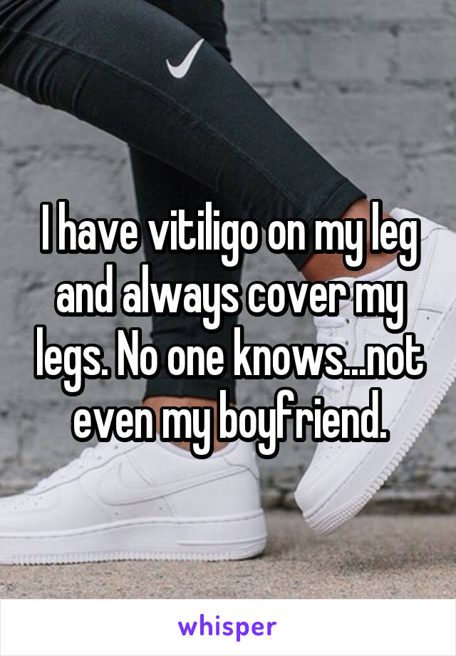 I have vitiligo on my leg and always cover my legs. No one knows...not even my boyfriend.
