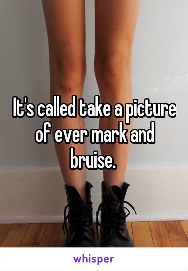 It's called take a picture of ever mark and bruise. 