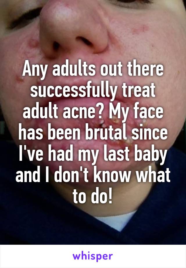 Any adults out there successfully treat adult acne? My face has been brutal since I've had my last baby and I don't know what to do!