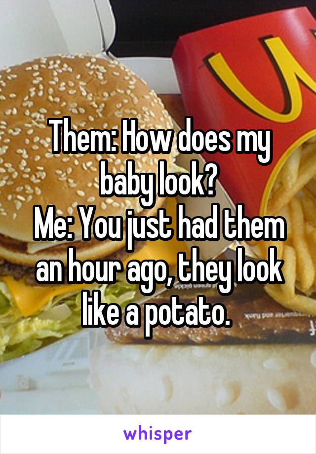 Them: How does my baby look?
Me: You just had them an hour ago, they look like a potato. 