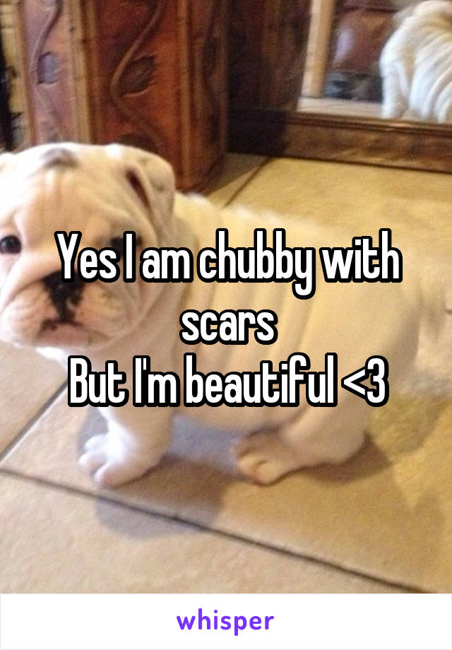 Yes I am chubby with scars
But I'm beautiful <3